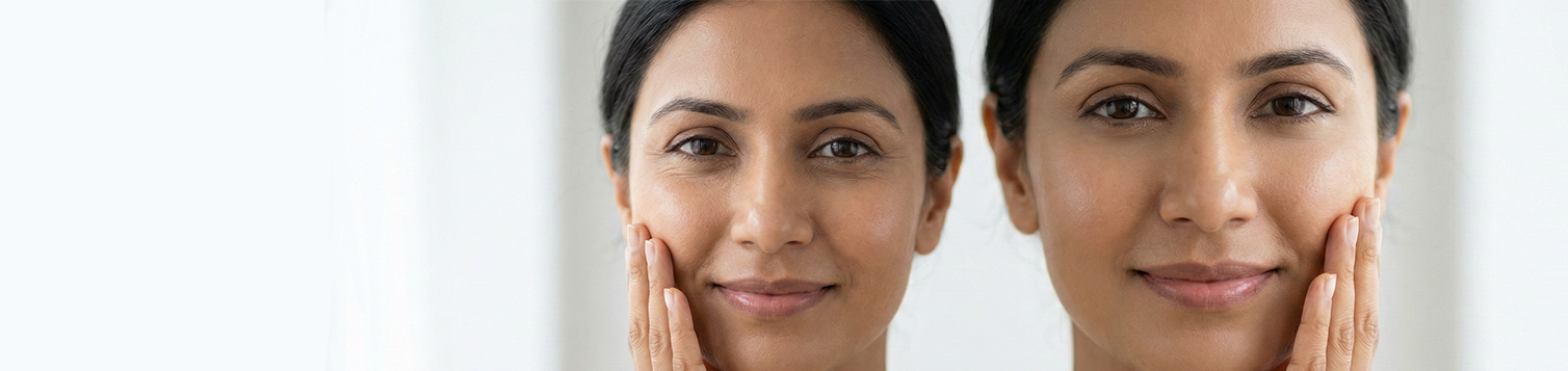Anti Aging