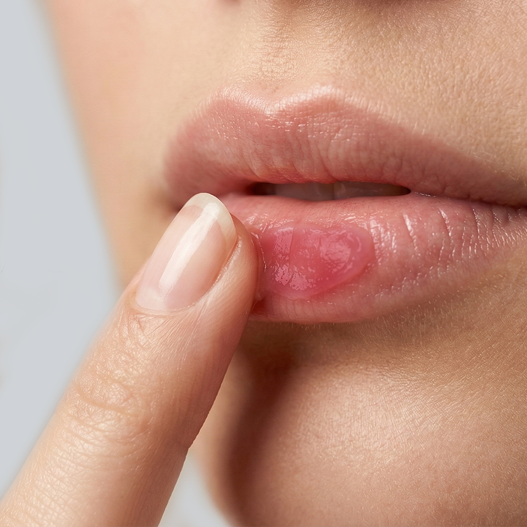 Lip Care