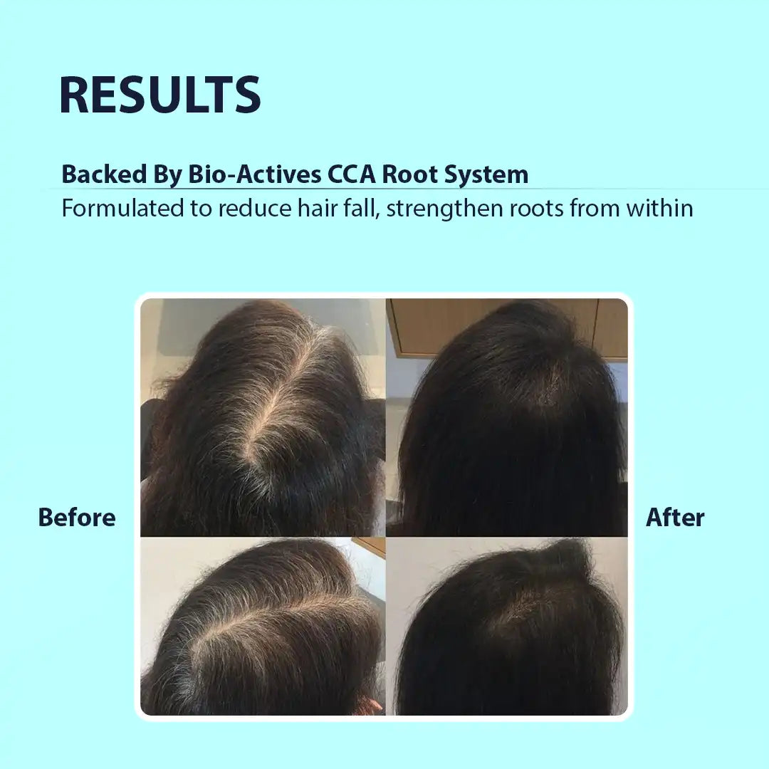 Hair Fall Control Shampoo with Caffeine & Arginine | Dermistry