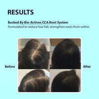 Hair Fall Control Shampoo with Caffeine & Arginine | Dermistry