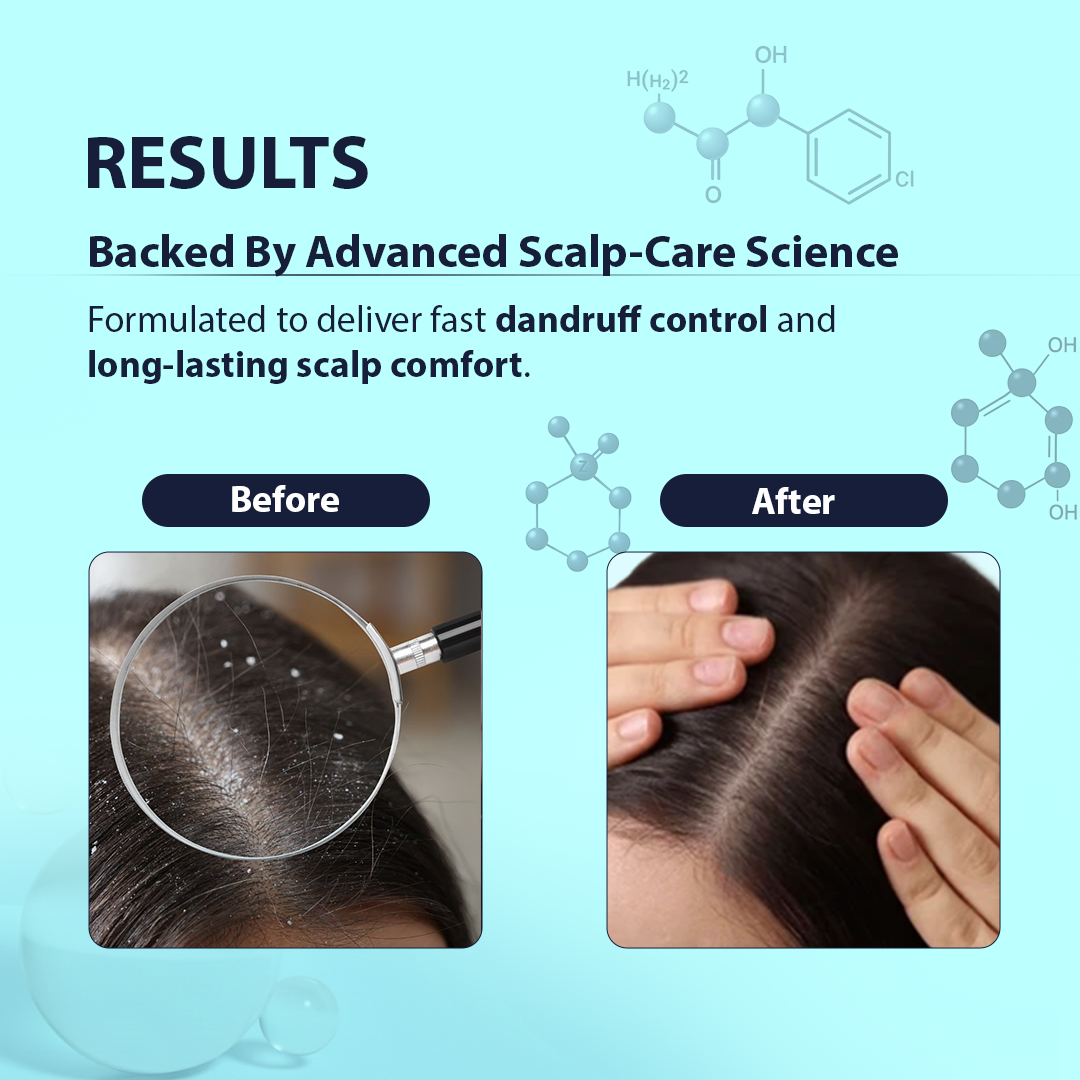 Anti Dandruff Shampoo