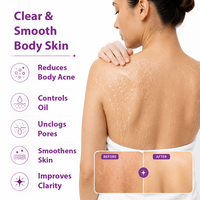 A promotional graphic for a body skin treatment showing a woman from the back with clear, smooth skin and a white towel. Text on the left lists benefits: reduces body acne, controls oil, unclogs pores, smooths skin, and improves clarity.
