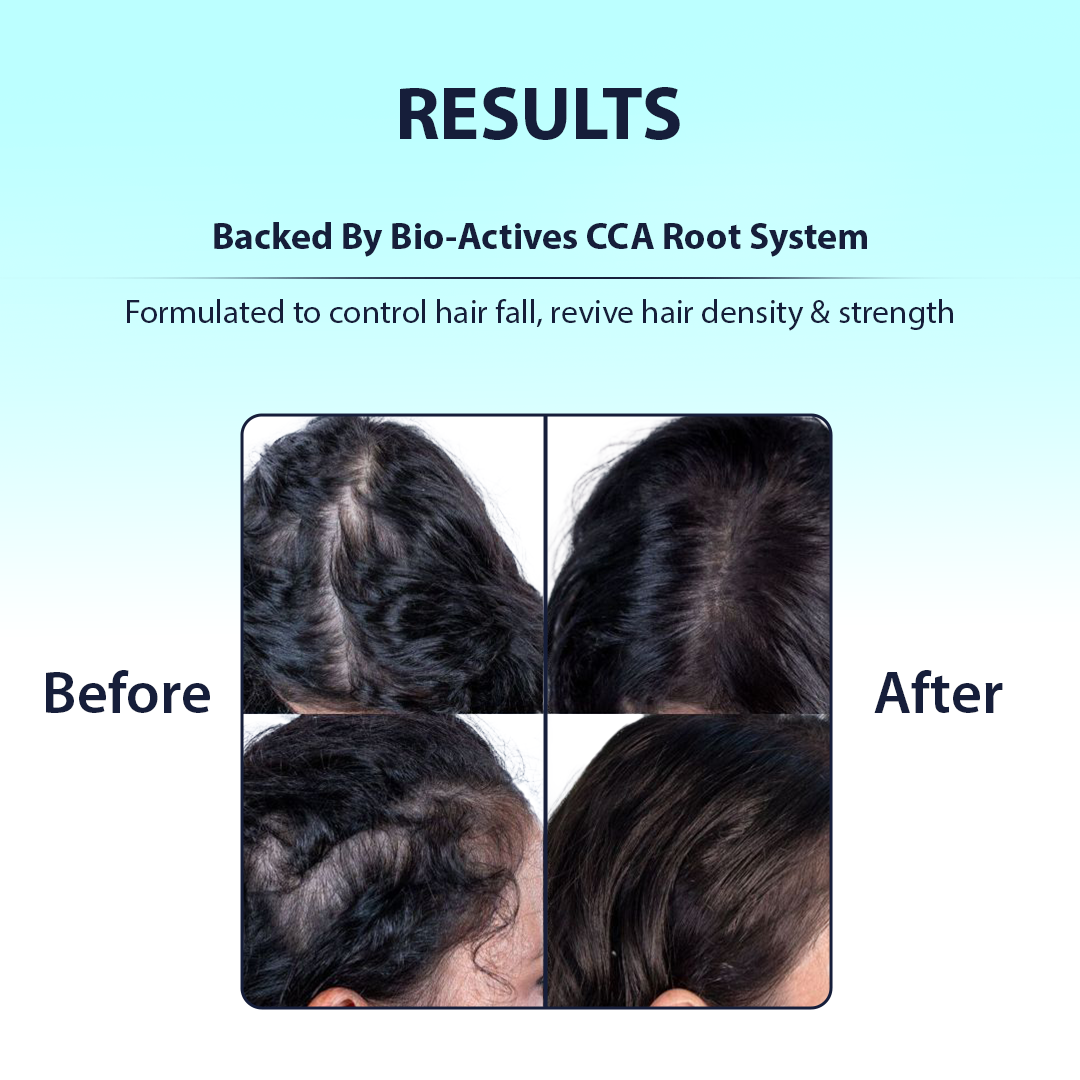 Hair results