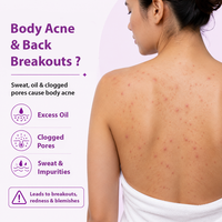 A woman shown from the back with visible body acne and red blemishes, alongside text explaining body acne and back breakouts, with icons for excess oil, clogged pores, sweat & impurities, and a warning about breakouts, redness, and blemishes.