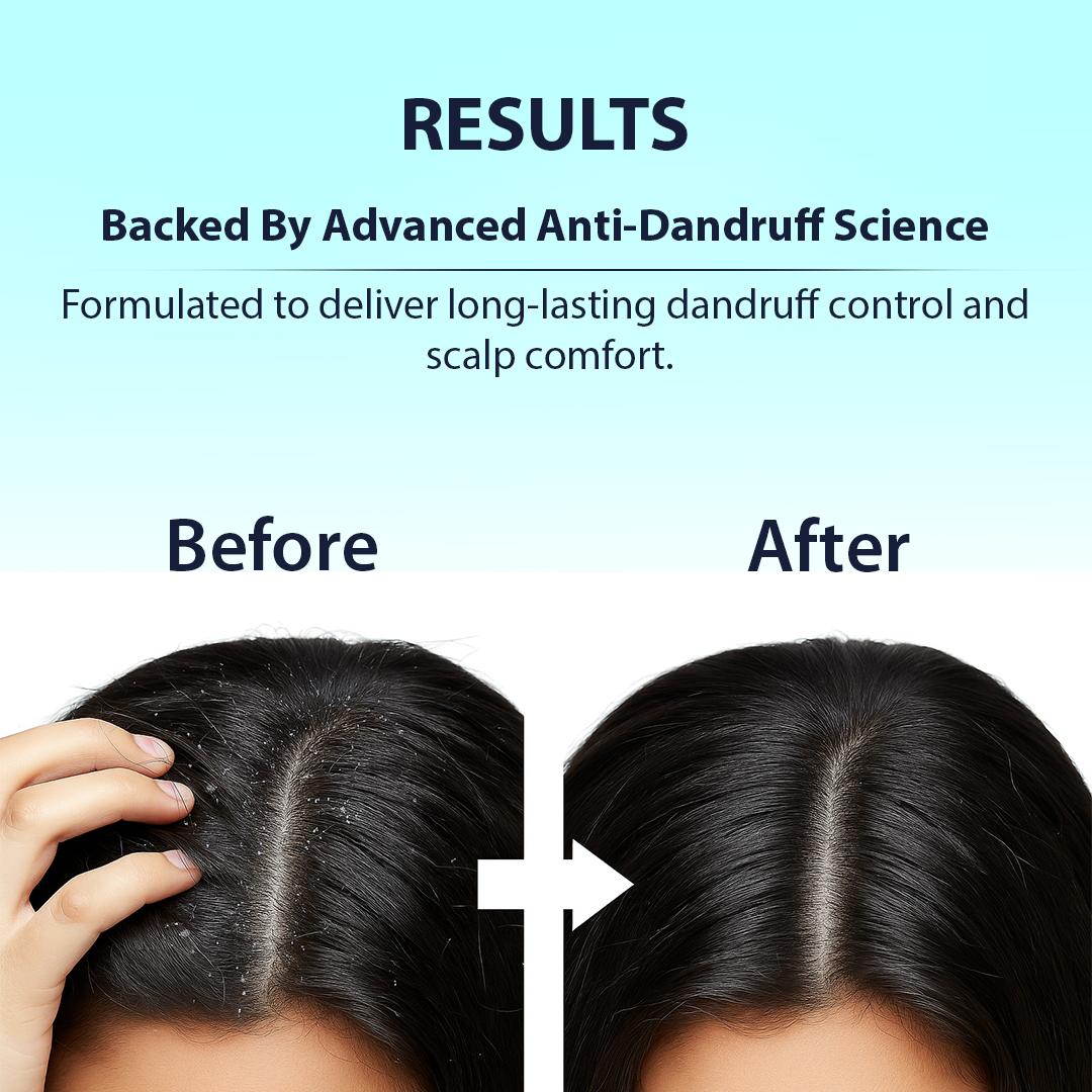 Soothing scalp serum bottle