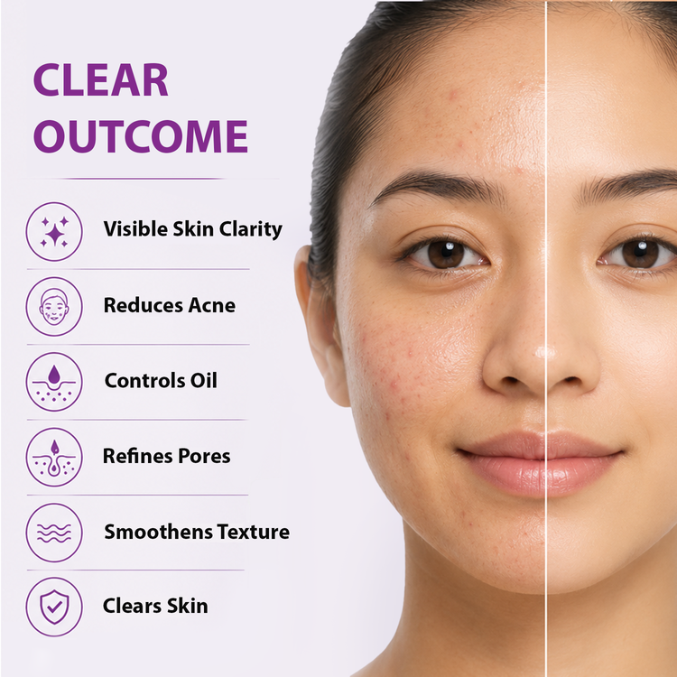 Close-up of a woman's face split down the middle, with the right side showing clearer, smoother skin and the left side showing blemishes and texture. Text on the left reads 'CLEAR OUTCOME' with icons and bullet points for visible skin clarity, reduced acne, controlled oil, refined pores, smoothed texture, and clear skin.