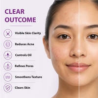 Close-up of a woman's face split down the middle, with the right side showing clearer, smoother skin and the left side showing blemishes and texture. Text on the left reads 'CLEAR OUTCOME' with icons and bullet points for visible skin clarity, reduced acne, controlled oil, refined pores, smoothed texture, and clear skin.