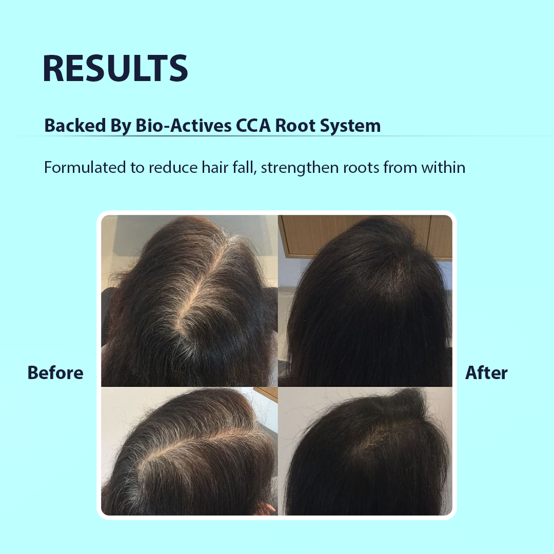 Before and after comparison of hair treatment with text about Bio-Actives CCA Root System.