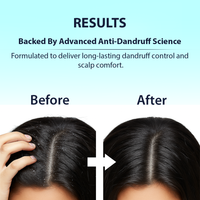 Before and after comparison of dandruff control with text about advanced anti-dandruff science.