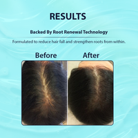shampoo results
